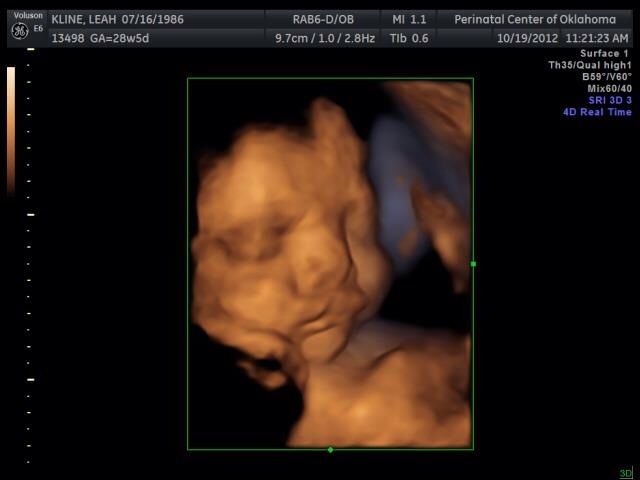 19 week 4d ultrasound pictures 19 week 4d ultrasound pictures